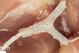 科学家首次实现用3D打印导板辅助受损复杂神经再生（图文教程） ...