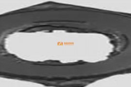 注塑产品出现毛边的原因及应对措施